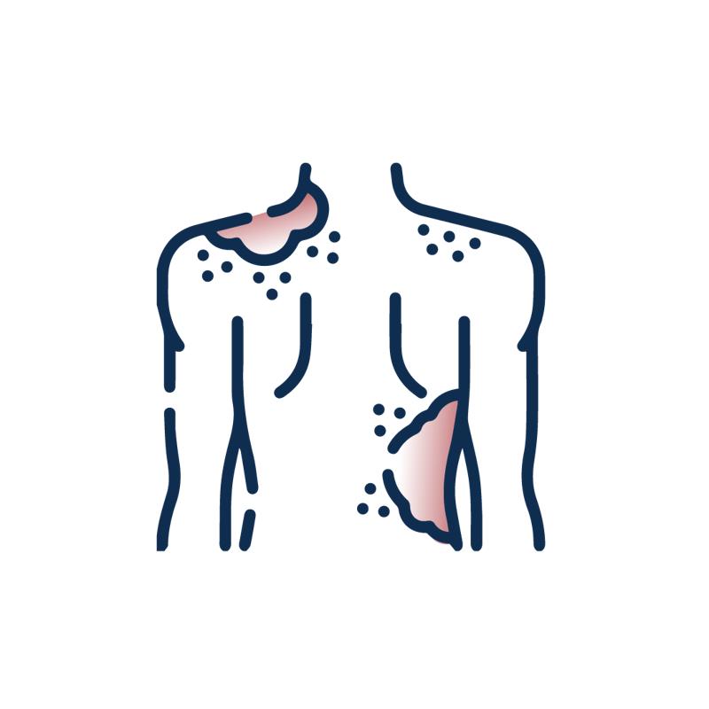 mycoses-1.jpg